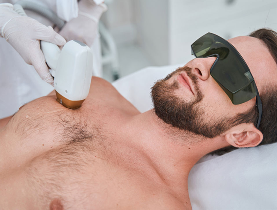 Epilazione Permanente Uomo: la scelta migliore per l’estate